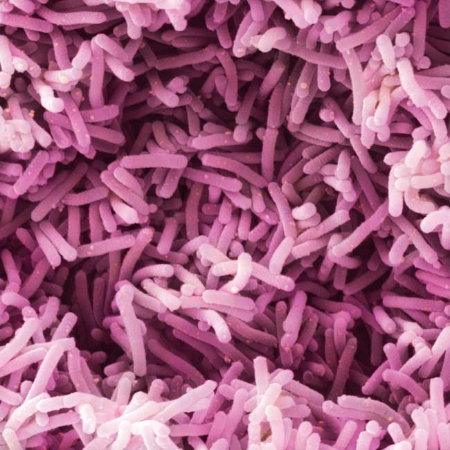 A microscopic photo of bacteria, which appears in several shades of purple. 
